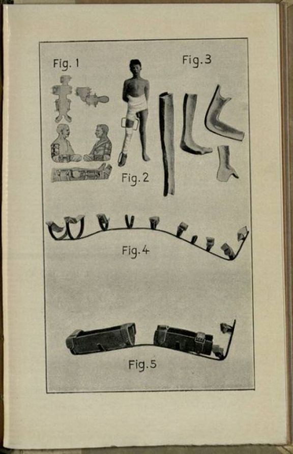 Il *trattamento delle fratture in guerra  / Vittorio Putti