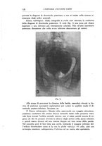 giornale/BVE0242834/1935/unico/00000134