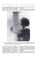 giornale/BVE0244796/1935/v.1/00000095