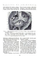 giornale/BVE0244796/1935/v.1/00000117