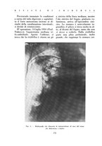giornale/BVE0244796/1935/v.1/00000190