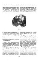 giornale/BVE0244796/1935/v.1/00000269