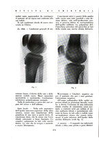 giornale/BVE0244796/1935/v.2/00000088