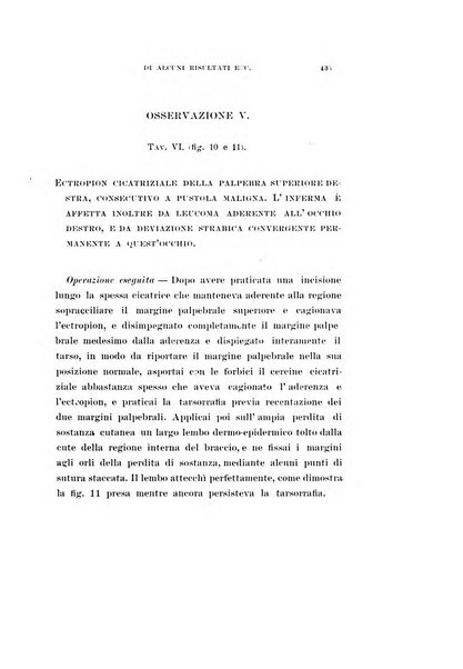 Archivio di ottalmologia giornale mensile