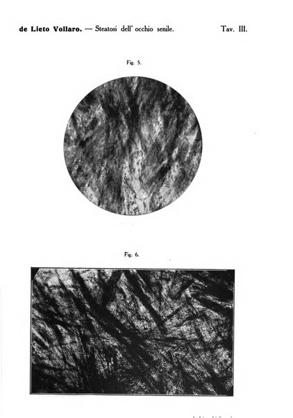 Archivio di ottalmologia giornale mensile