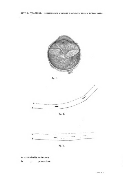 Archivio di ottalmologia giornale mensile