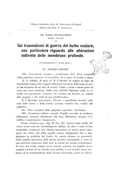 Archivio di ottalmologia giornale mensile