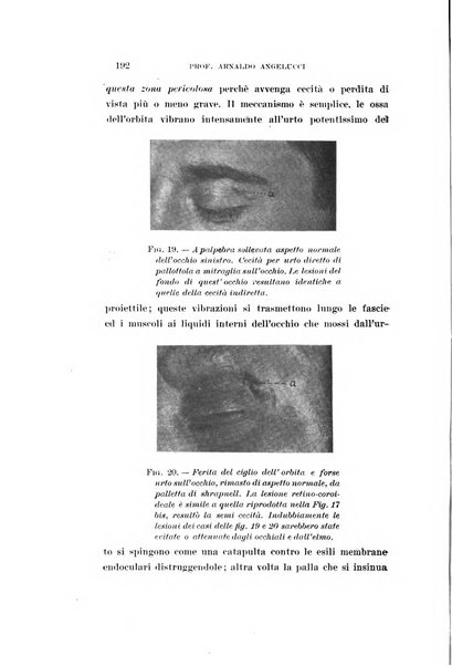 Archivio di ottalmologia giornale mensile