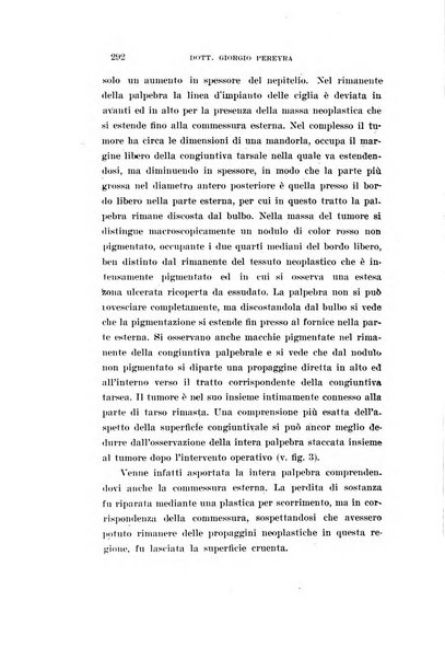 Archivio di ottalmologia giornale mensile