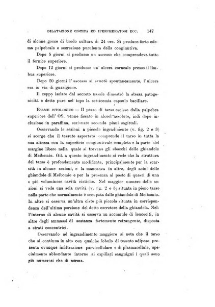 Archivio di ottalmologia giornale mensile