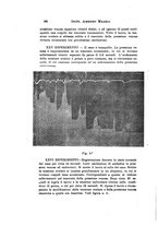 giornale/CAG0050194/1920/unico/00000114