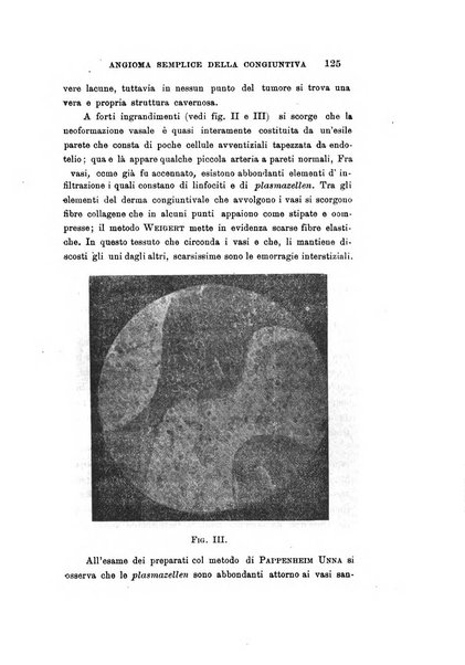 Archivio di ottalmologia giornale mensile