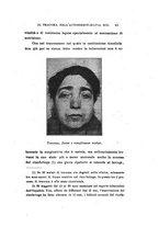 giornale/CAG0050194/1925/unico/00000047