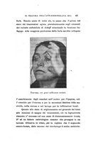 giornale/CAG0050194/1925/unico/00000049