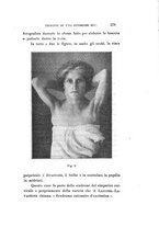 giornale/CAG0050194/1925/unico/00000303
