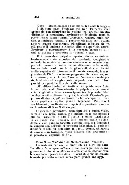 Archivio di ottalmologia giornale mensile