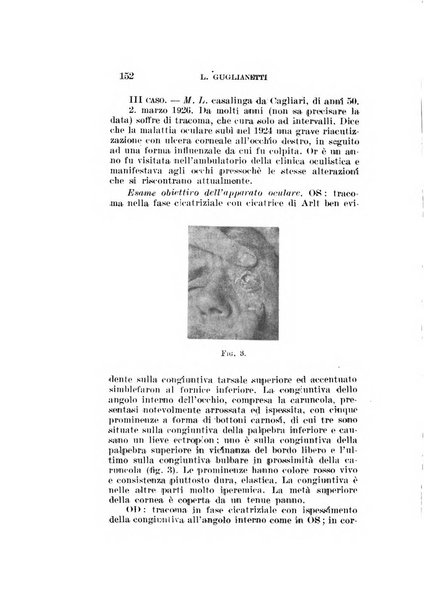 Archivio di ottalmologia giornale mensile