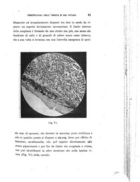 Archivio di ottalmologia giornale mensile