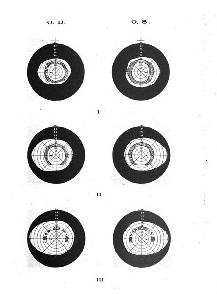 Archivio di ottalmologia giornale mensile