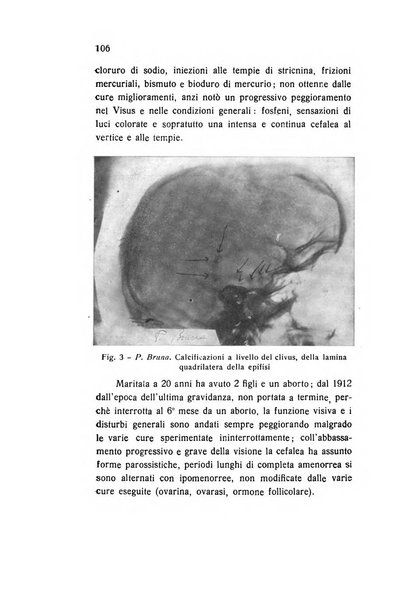 Archivio di ottalmologia giornale mensile