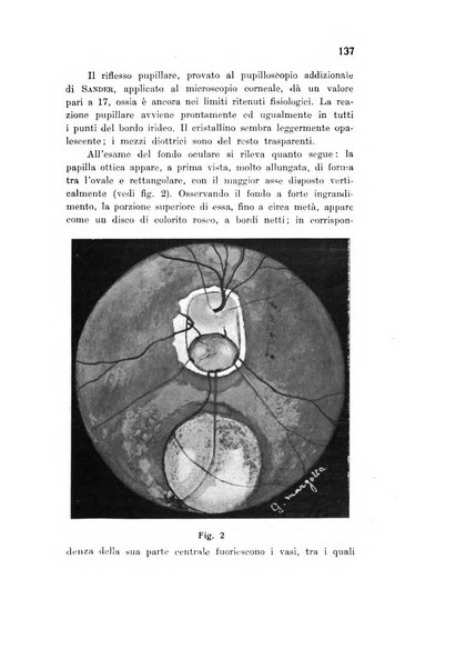 Archivio di ottalmologia giornale mensile