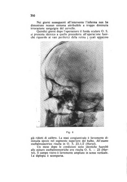 Archivio di ottalmologia giornale mensile