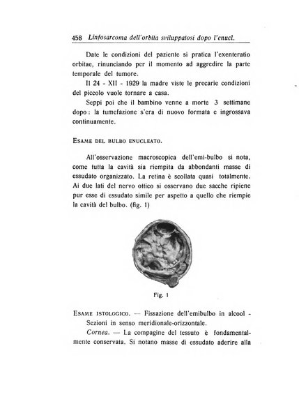 Archivio di ottalmologia giornale mensile