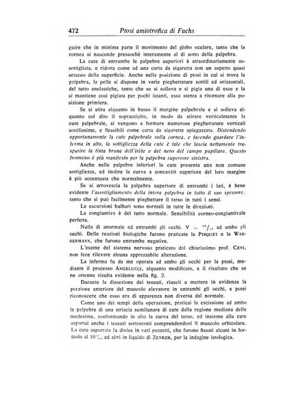 Archivio di ottalmologia giornale mensile