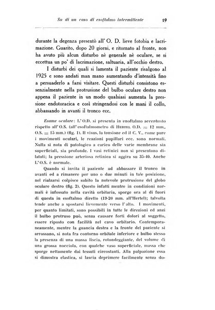 Archivio di ottalmologia giornale mensile