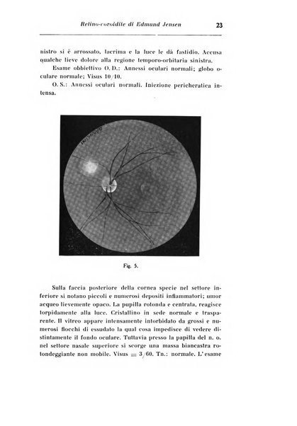 Archivio di ottalmologia giornale mensile