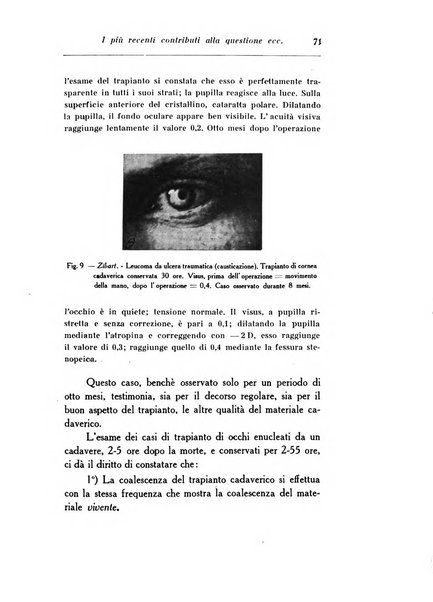 Archivio di ottalmologia giornale mensile