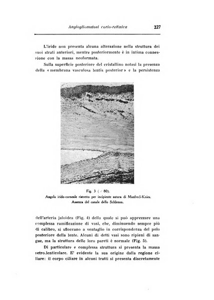 Archivio di ottalmologia giornale mensile