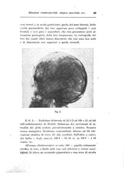 Archivio di ottalmologia giornale mensile