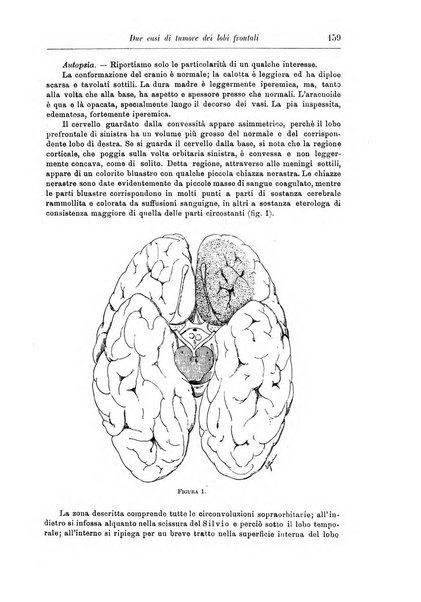 Rivista di patologia nervosa e mentale