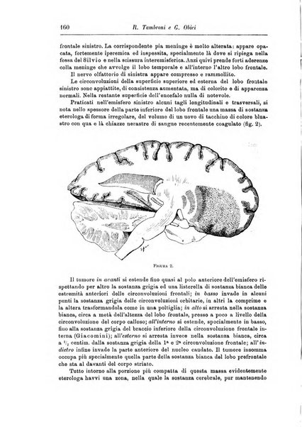 Rivista di patologia nervosa e mentale