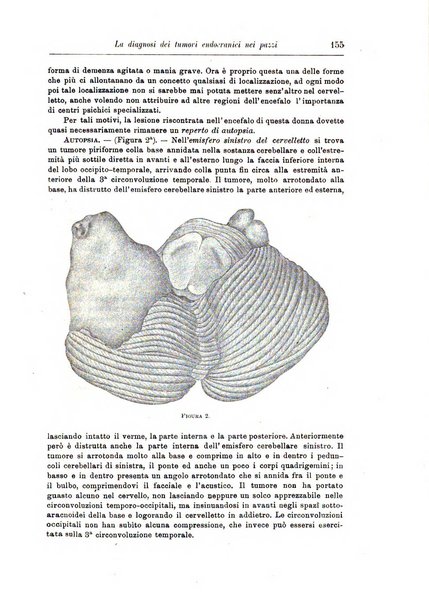 Rivista di patologia nervosa e mentale