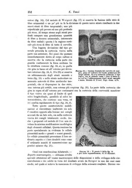 Rivista di patologia nervosa e mentale