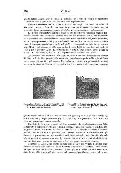 Rivista di patologia nervosa e mentale