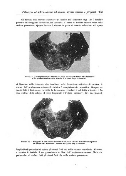 Rivista di patologia nervosa e mentale