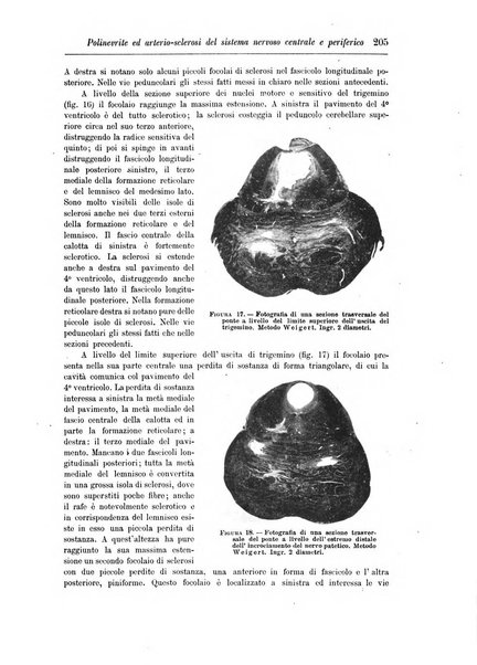 Rivista di patologia nervosa e mentale