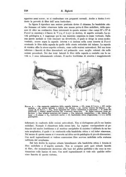 Rivista di patologia nervosa e mentale