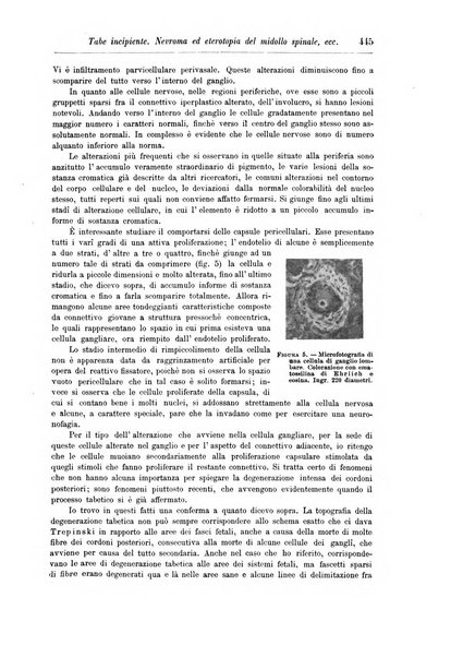 Rivista di patologia nervosa e mentale