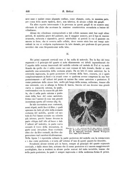 Rivista di patologia nervosa e mentale