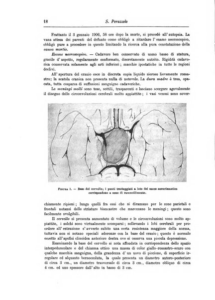 Rivista di patologia nervosa e mentale