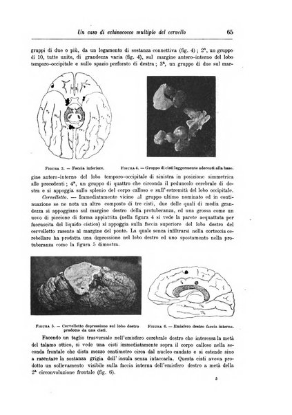 Rivista di patologia nervosa e mentale