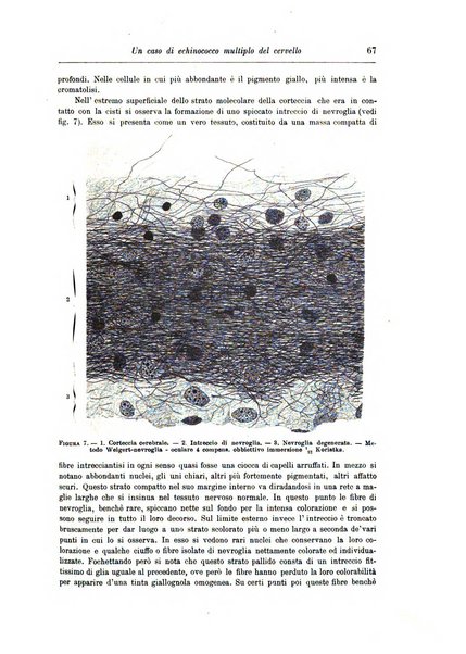 Rivista di patologia nervosa e mentale