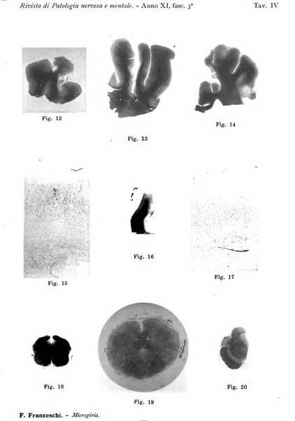 Rivista di patologia nervosa e mentale