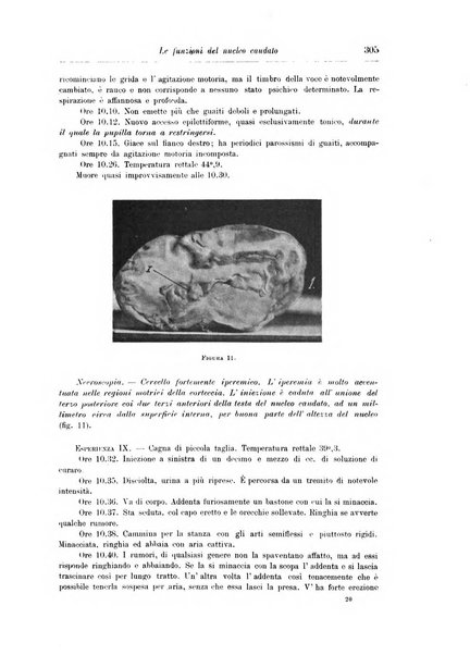 Rivista di patologia nervosa e mentale