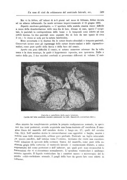 Rivista di patologia nervosa e mentale