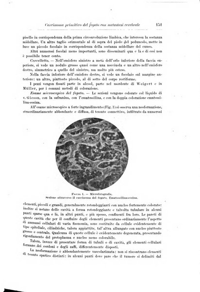 Rivista di patologia nervosa e mentale